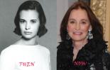 Прикрепленное изображение: Gloria-Vanderbilt-Plastic-Surgery-1.jpg